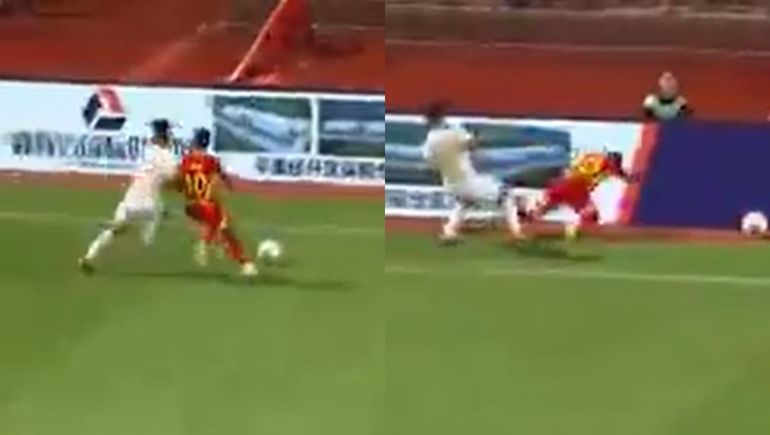 Un futbolista podría quedar discapacitado de por vida tras chocar su cabeza con un cartel publicitario.