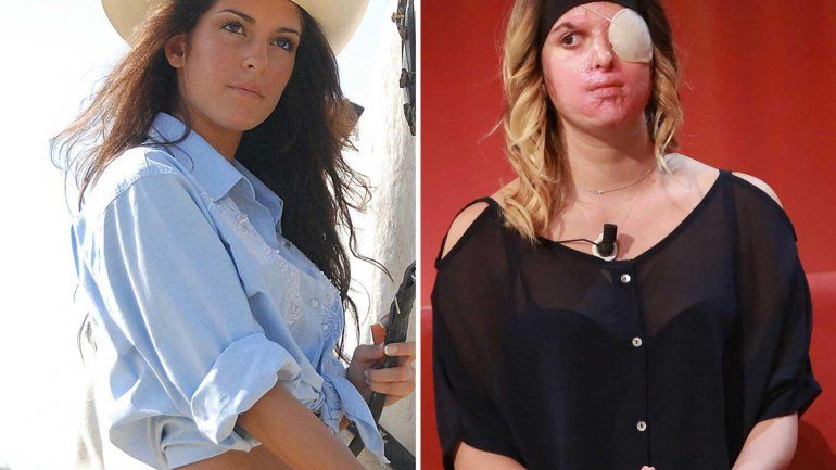 El antes y el después de Gessica Notaro