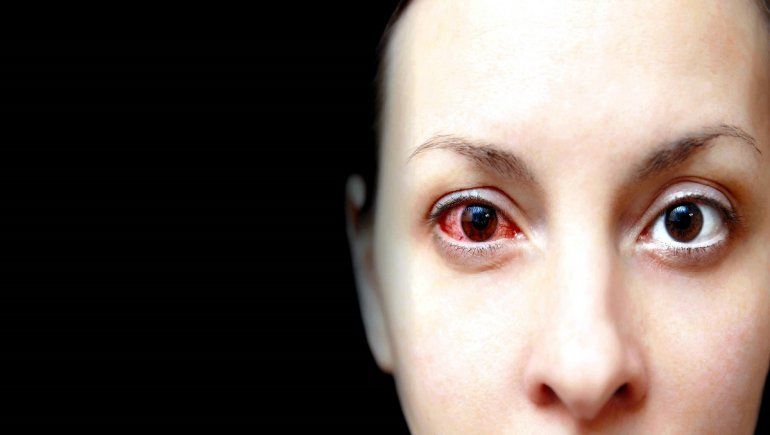 El nuevo coronavirus puede afectar la vista en pacientes graves.