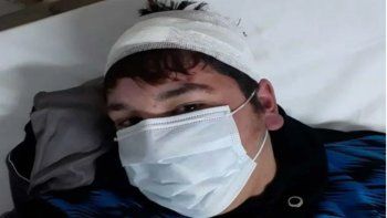 joven de san martin de los andes denuncio abuso policial joven de san martin de los andes denuncio abuso policial