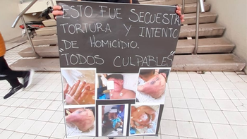La víctima tiene una discapacidad motriz y no logró defenderse de los golpes. La víctima tiene una discapacidad motriz y no logró defenderse de los golpes.