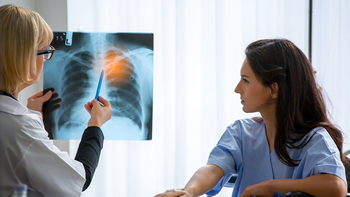 cuanto antes, mejor: detectar el cancer de pulmon a tiempo salva vidas