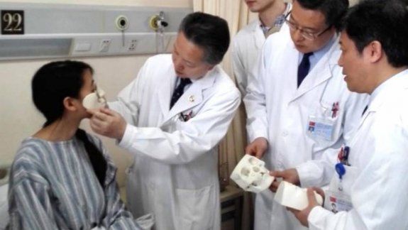 La chica se llama Jin Qi y perdió parte de la cara por una infección.