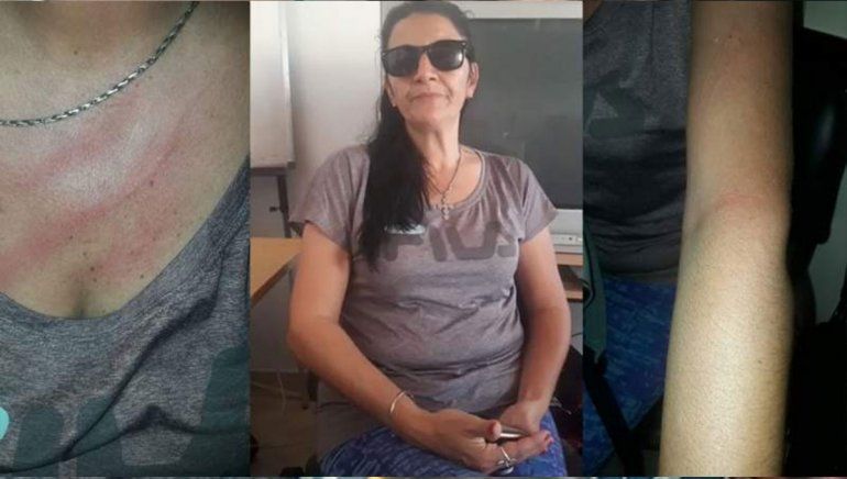 Brutal agresión al aire: el dueño de una radio atacó a una locutora y un oyente llamó al 911