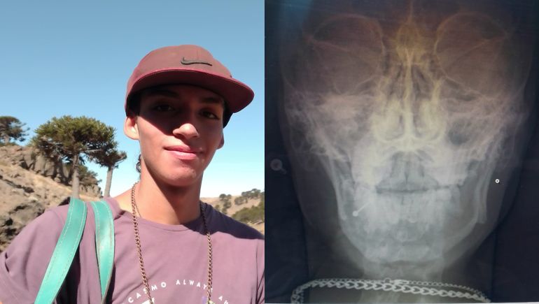 Hacen una rifa para acompañar a su hijo que será operado