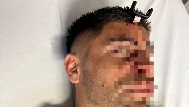 La agresión que recibió el jugador del Ascenso