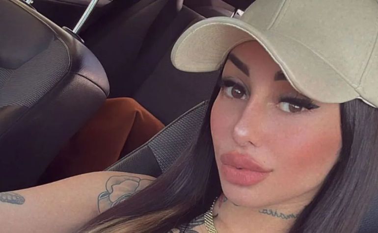 Tamara Báez sigue en la búsqueda de su mejor versión, con ayuda de la cirugía estética. Tamara Báez sigue en la búsqueda de su mejor versión, con ayuda de la cirugía estética.