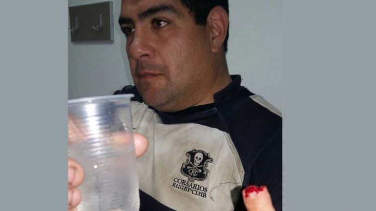 El estilo Tyson llegó al rugby: un jugador le arrancó un dedo a otro