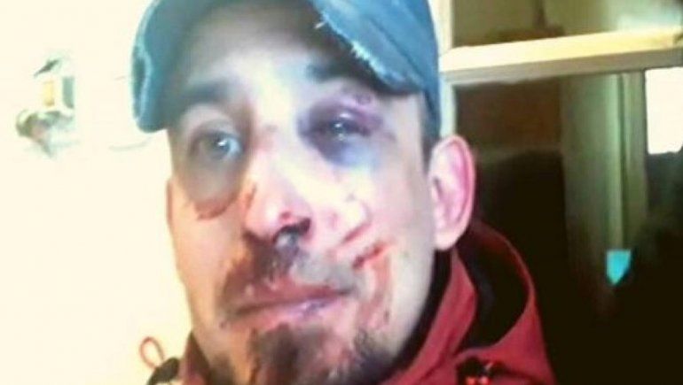 Abuso policial: sacó a pasear a su perro y fue brutalmente golpeado