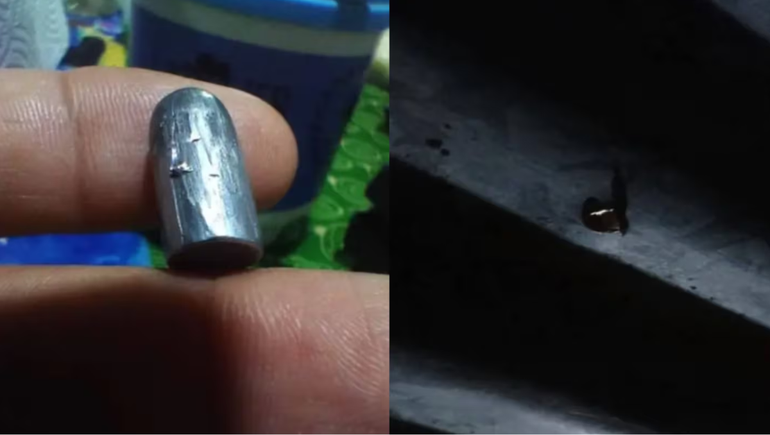 Una nena fue herida por una bala perdida en Salta.