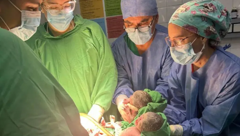 Las bebés compartían placenta y nacieron por cesárea programada a las 34 semanas de gestación.