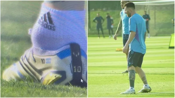 una pelota de tenis: preocupante imagen del tobillo de messi una pelota de tenis: preocupante imagen del tobillo de messi