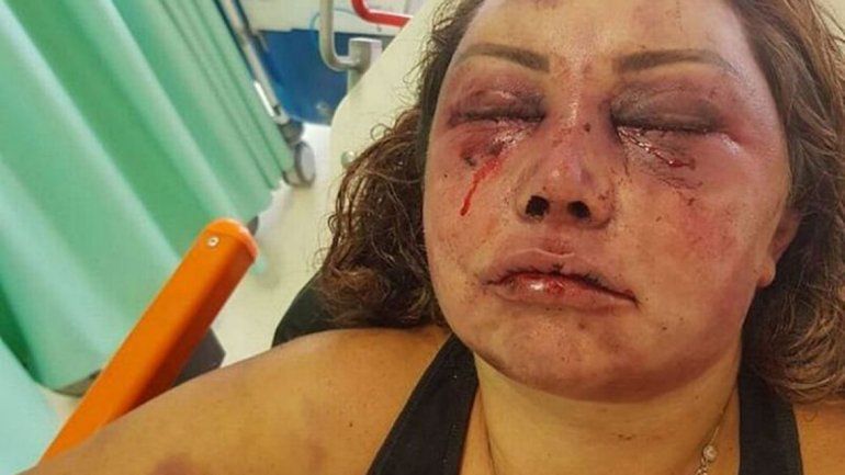 Primera cita de terror: la desfiguró a trompadas