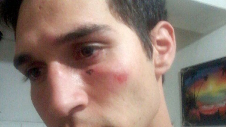 El joven mostró las marcas que le quedaron en el cuerpo y la cara después de la pelea familiar y la intervención de los policías de la Comisaría 41ª.