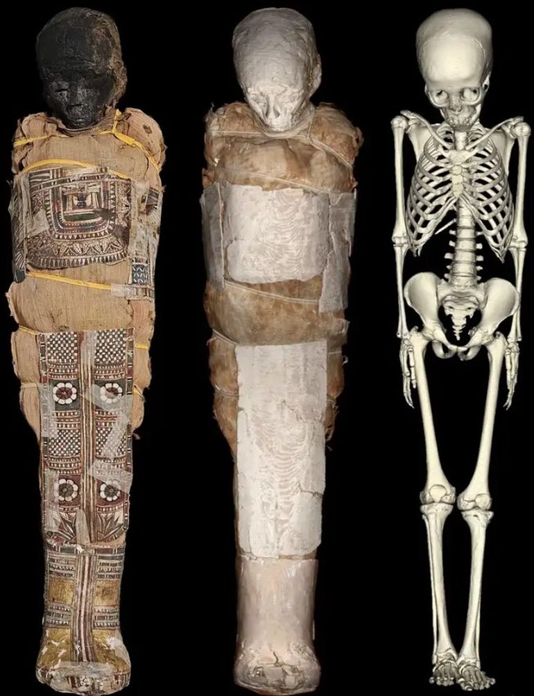 El elemento detectado en el pecho de la momia se convirtió en el principal foco de estudio El elemento detectado en el pecho de la momia se convirtió en el principal foco de estudio