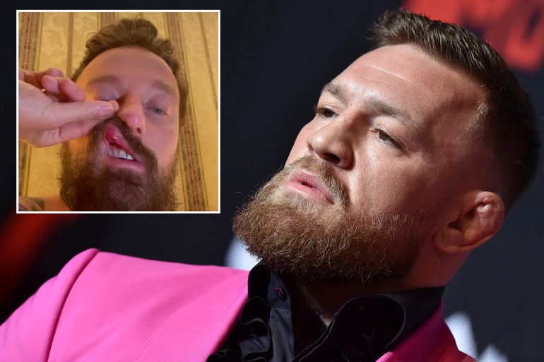 Escándalo: McGregor fue al Vaticano a bautizar al hijo y le dio una golpiza a un DJ