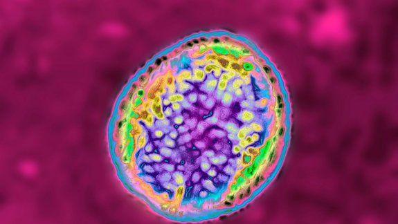 China: 3000 enfermos por la fuga de una bacteria de un laboratorio
