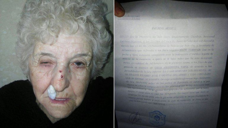Golpean a una abuela para robarle la cartera en San Juan y la policía le pide examen ginecológico.