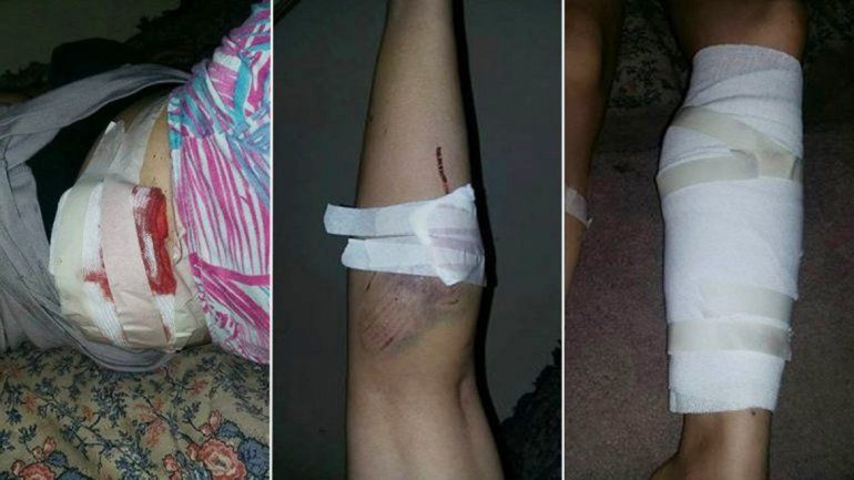 La víctima subió fotos de las heridas a la red social Facebook.