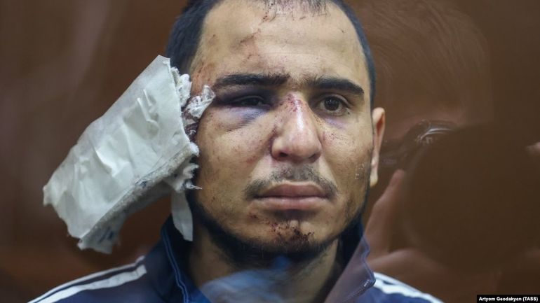 Uno de los detenidos, con la oreja cortada y golpes en la cara Uno de los detenidos, con la oreja cortada y golpes en la cara