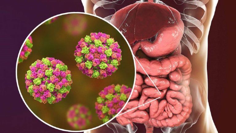 Norovirus: alertas en Europa por su propagación