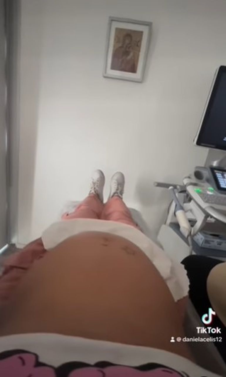 Daniela se hizo una ecografía para confirmar si espera gemelos o trillizos. Daniela se hizo una ecografía para confirmar si espera gemelos o trillizos.