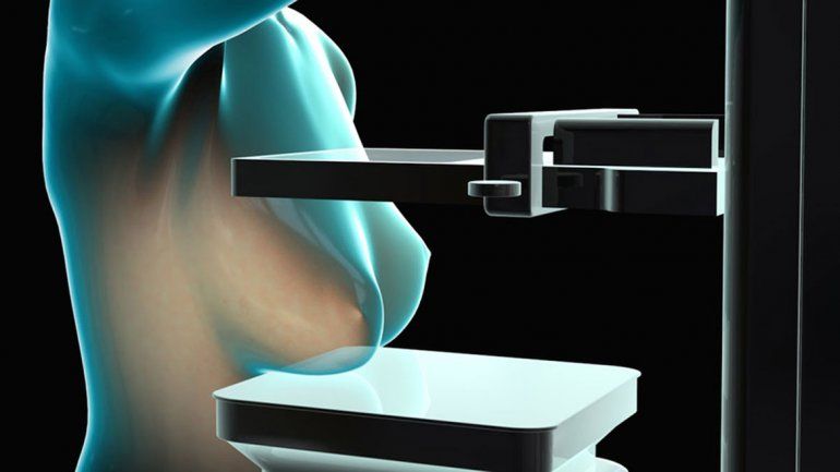 Diseñan un mamógrafo que no necesita rayos X