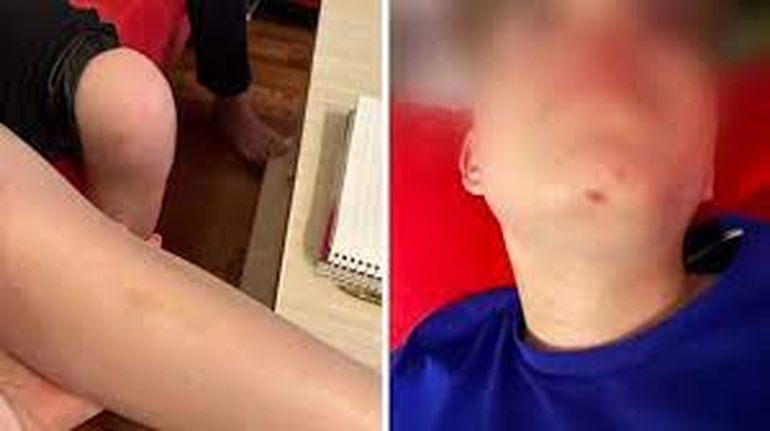 Un día de furia: pareja atacó a pelotazos de golf a nene de 10 años