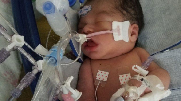 Murió el bebé al que quitaron del vientre materno