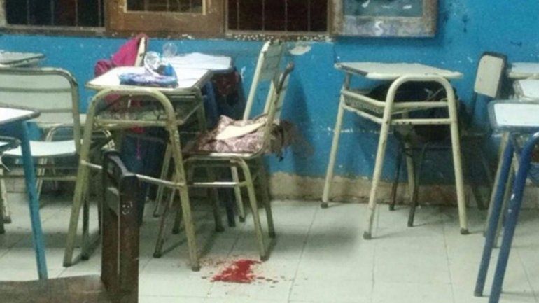 No están claras las circunstancias en las que se produjo el hecho. El chico le dijo a la Policía que fue un accidente.