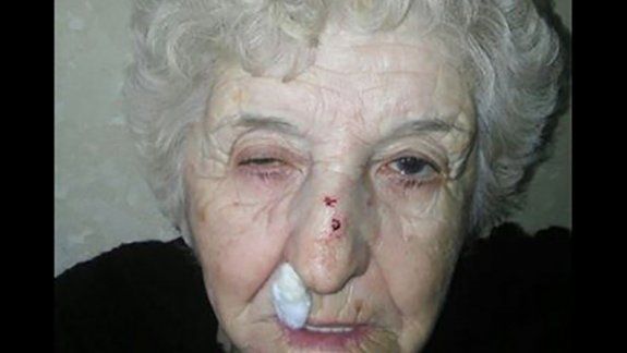 Lidia Tapia fue asaltada y la policía le pidió un análisis vaginal y anal.