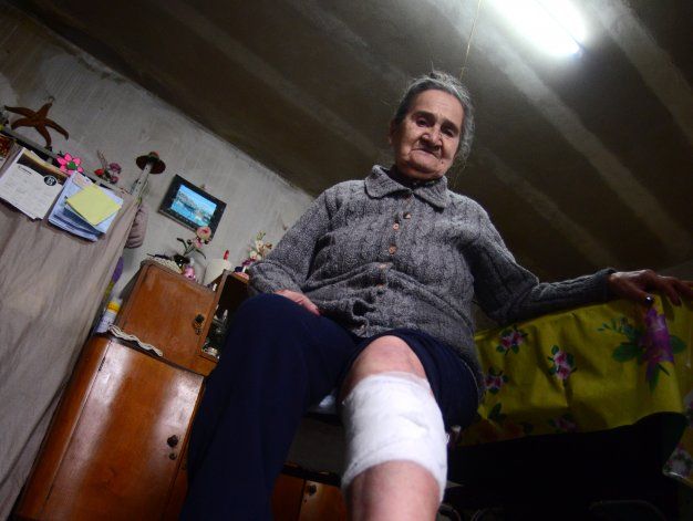 Otro brutal ataque de un pitbull: anciana salvó su vida de milagro