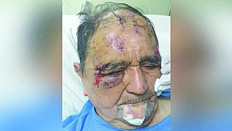 Desfigurado quedó el abuelo que sufrió el brutal robo en Rincón.