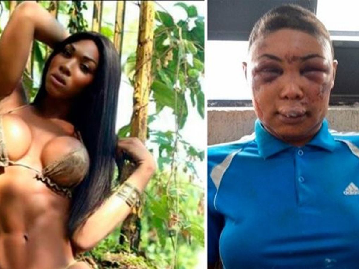 Brazilian Transgender Woman Attacked by Police in Prison | News | BET