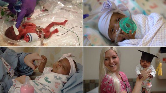 Le dieron el alta a la beba más pequeña del mundo