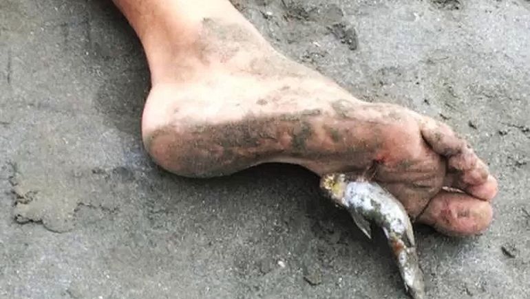 Chubut: les recomiendan a los bañistas que tengan especial cuidado con los bagres de mar.