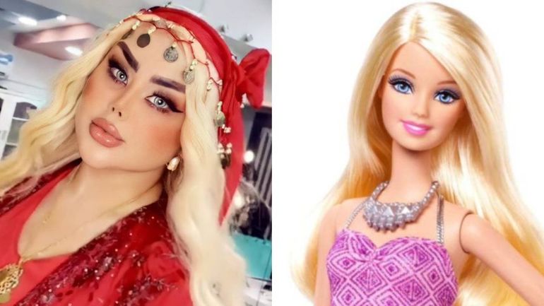 Gastó una fortuna en cirugías estéticas para parecerse a Barbie. Gastó una fortuna en cirugías estéticas para parecerse a Barbie.