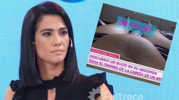 Delfina-Gerez-Bosco,-la-ex-bañera-de-Marley,-contó-que-le-quitaron-un-tumor-de-750-gramos.jpg
