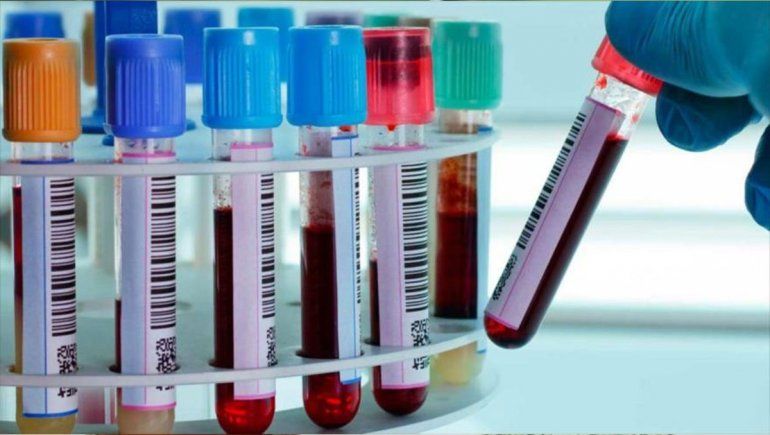 ¿Cuál es el grupo sanguíneo más vulnerable al coronavirus?