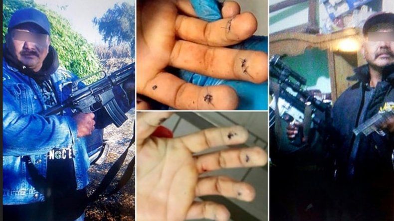 Kalimba lideraba una banda que robaba nafta. Además de cambiar el rostro, quería borrar sus huellas digitales.