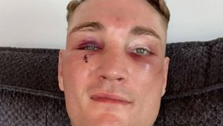 Desfiguró a su rival, le robaron la pelea y ahora Peralta tendrá revancha