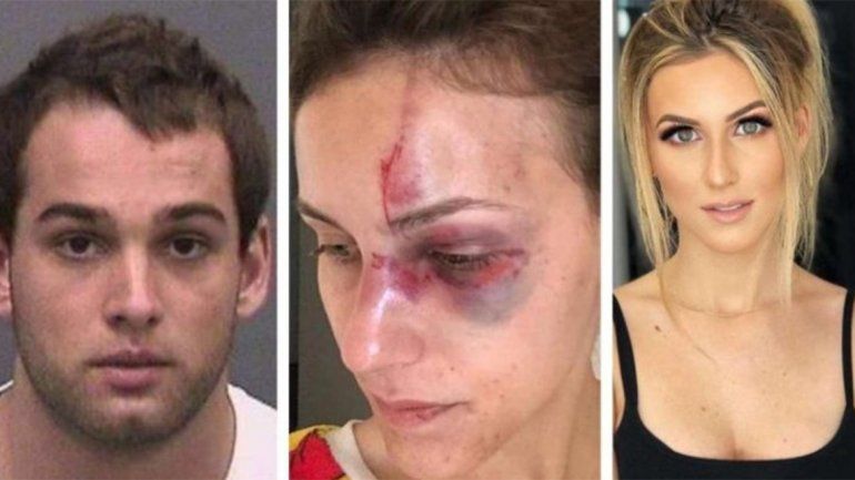 Brutal golpiza de un campeón de Motocross a su novia por una foto