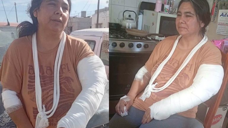 Andrea Manrique debió ser operada tras el ataque de los dogos en Trelew. Andrea Manrique debió ser operada tras el ataque de los dogos en Trelew.