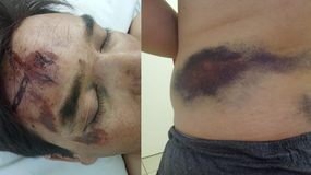 Sebastián es uno de los petroleros que fueron chocados en Ruta 51 y terminó internado en terapia intensiva durante seis días. | LM Neuquen Sebastián es uno de los petroleros que fueron chocados en Ruta 51 y terminó internado en terapia intensiva durante seis días.