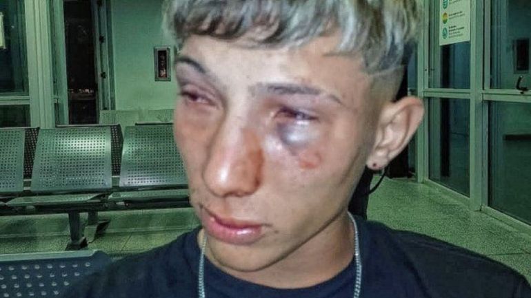 Brutal golpiza en un boliche: Me tiraron al piso y me molieron a golpes