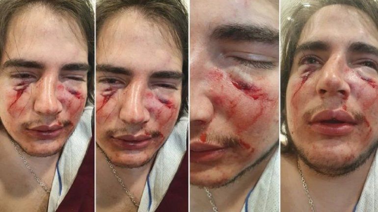 El joven agredido salvajemente por los rugbiers en Córdoba.