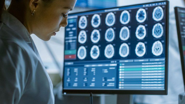 Hallan la proteína que previene el deterioro mental