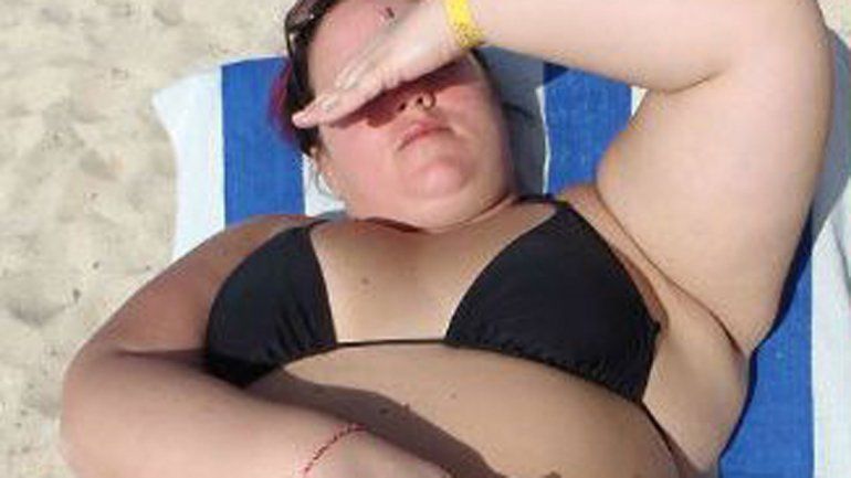 Los problemas de obesidad de Sara comenzaron casi 20 años atrás