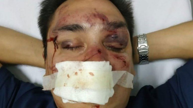 Periodista partidario recibió atroz golpiza de barras de Racing