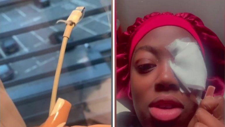 Viral en YouTube: explotó su cargador y casi la deja ciega.